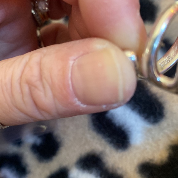 Ring - Picture 2 of 2